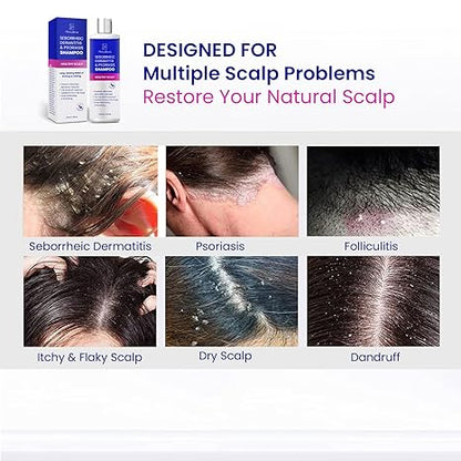 Psoriasis Shampoo for Scalp Treatment, Seborrheic Dermatitis Shampoo, Antifungal Shampoo, Dry Scalp Shampoo, Itchy Scalp Shampoo, Dandruff Shampoo, Folliculitis Shampoo, Scalp Psoriasis Treatment