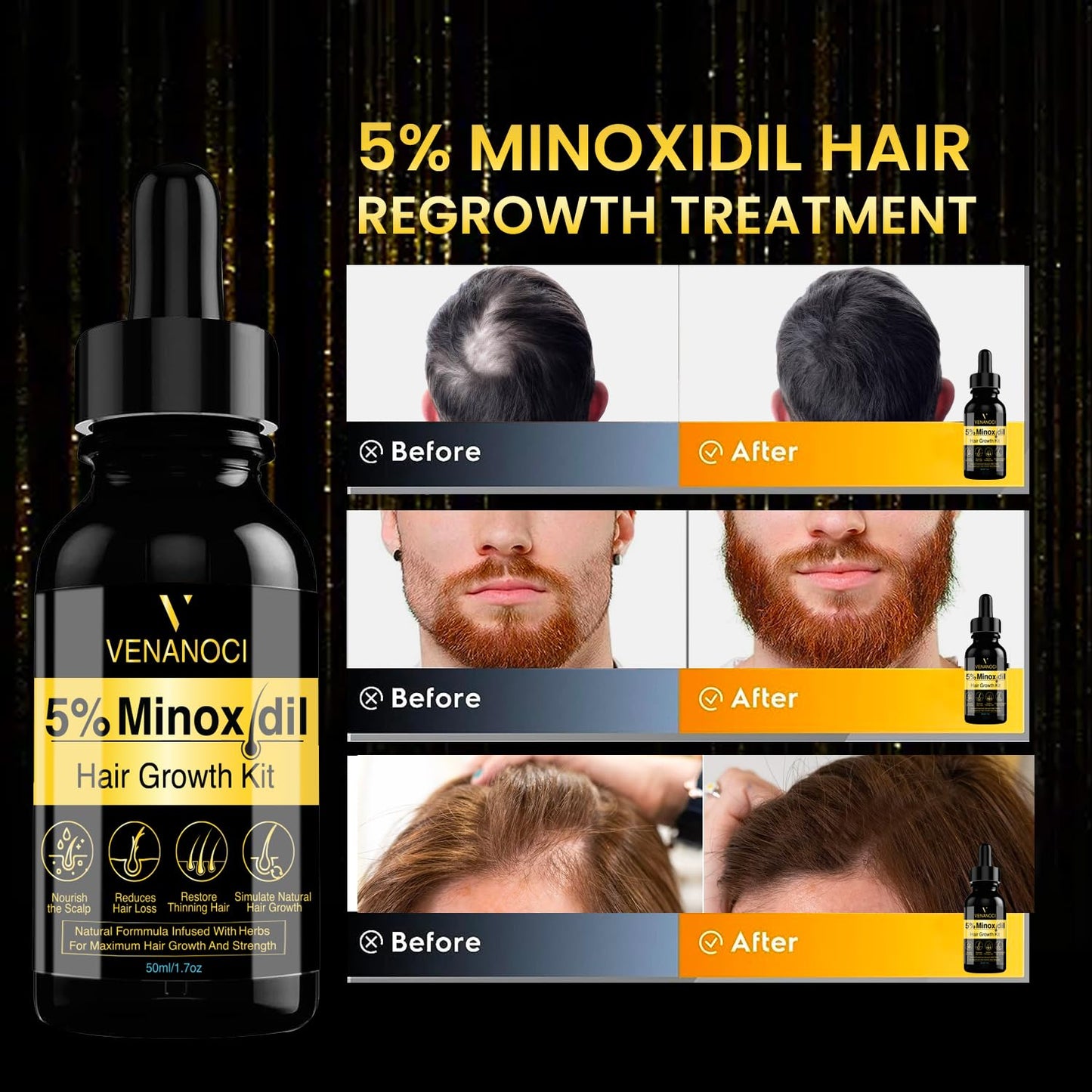 5% Minoxidil Hair Growth Spray For Men and Women 100Ml Hair Regrowth Treatment Serum For Stronger Thicker Longer Hair Help to Stop Thinning and loss hair 2 Month supply